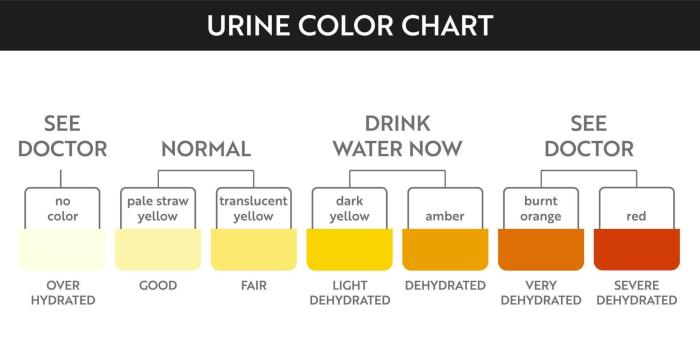 Dehydration urine color chart in spanish